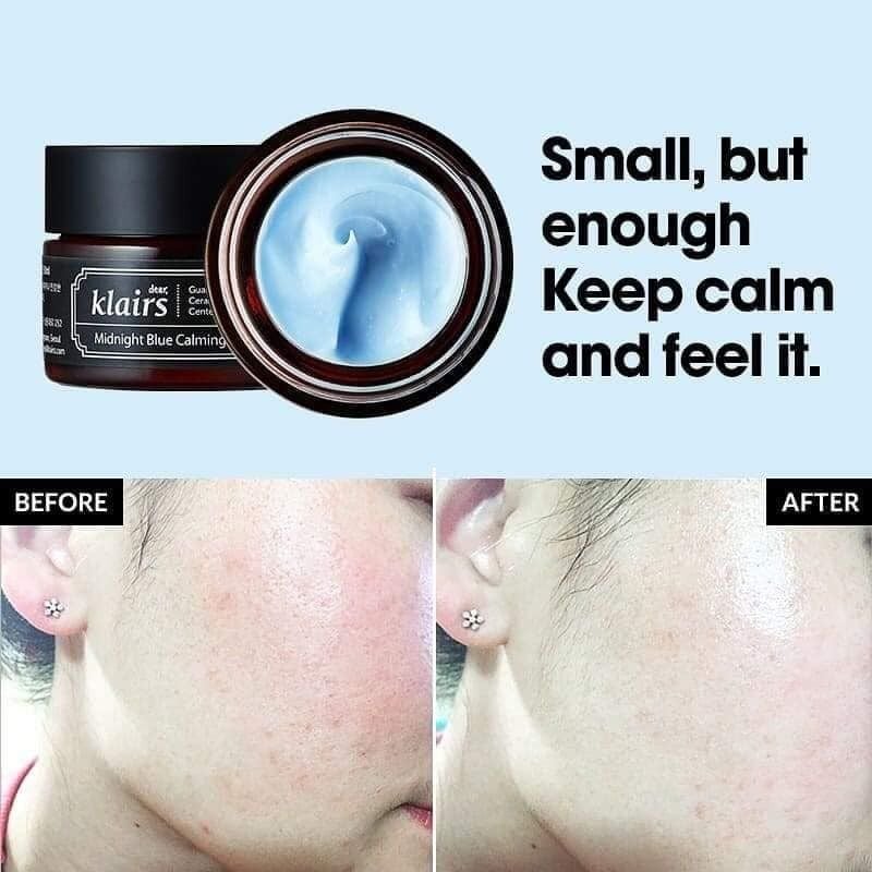 Klairs_Làm_Dịu_Phục_Hồi_Da_Ban ĐÊM